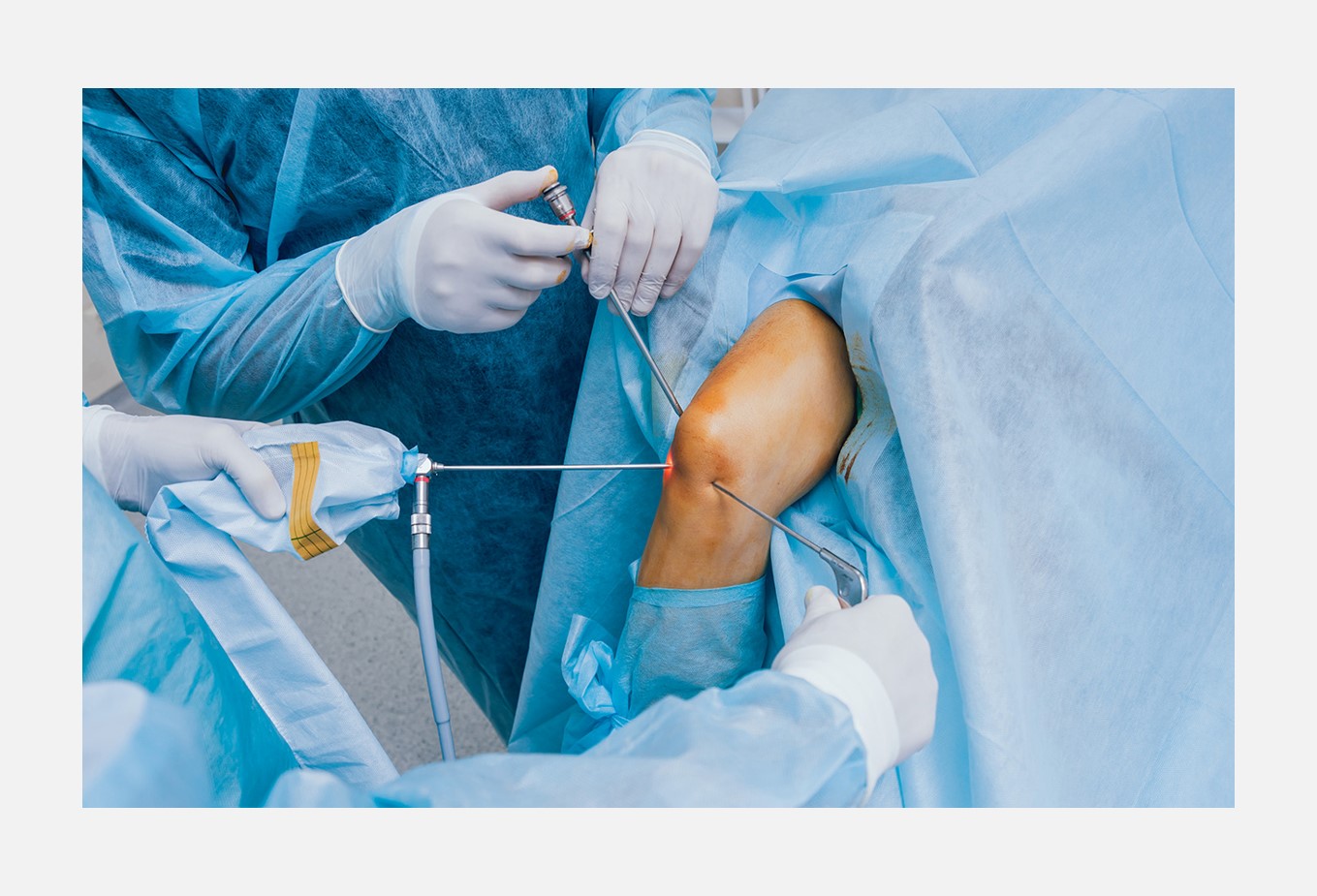 Arthroscopy