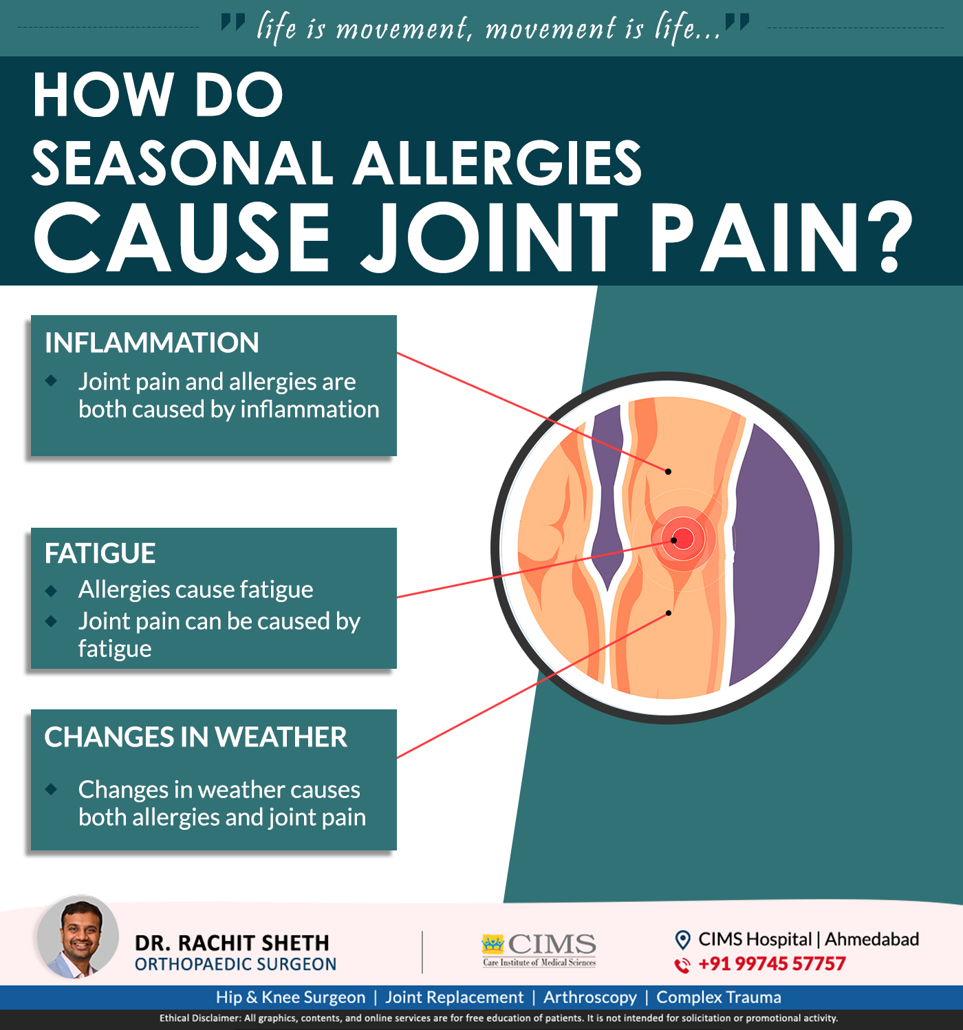 Seasonal allergies cause Joint Pain Dr. Rachit Sheth