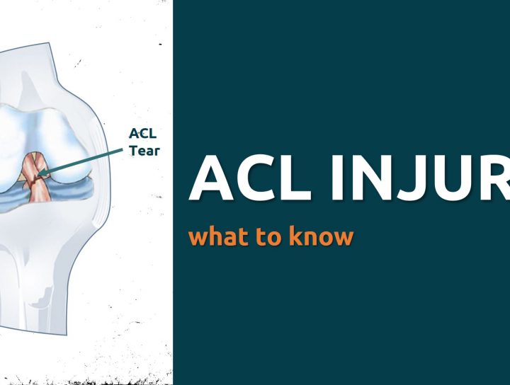 acl_injury_main