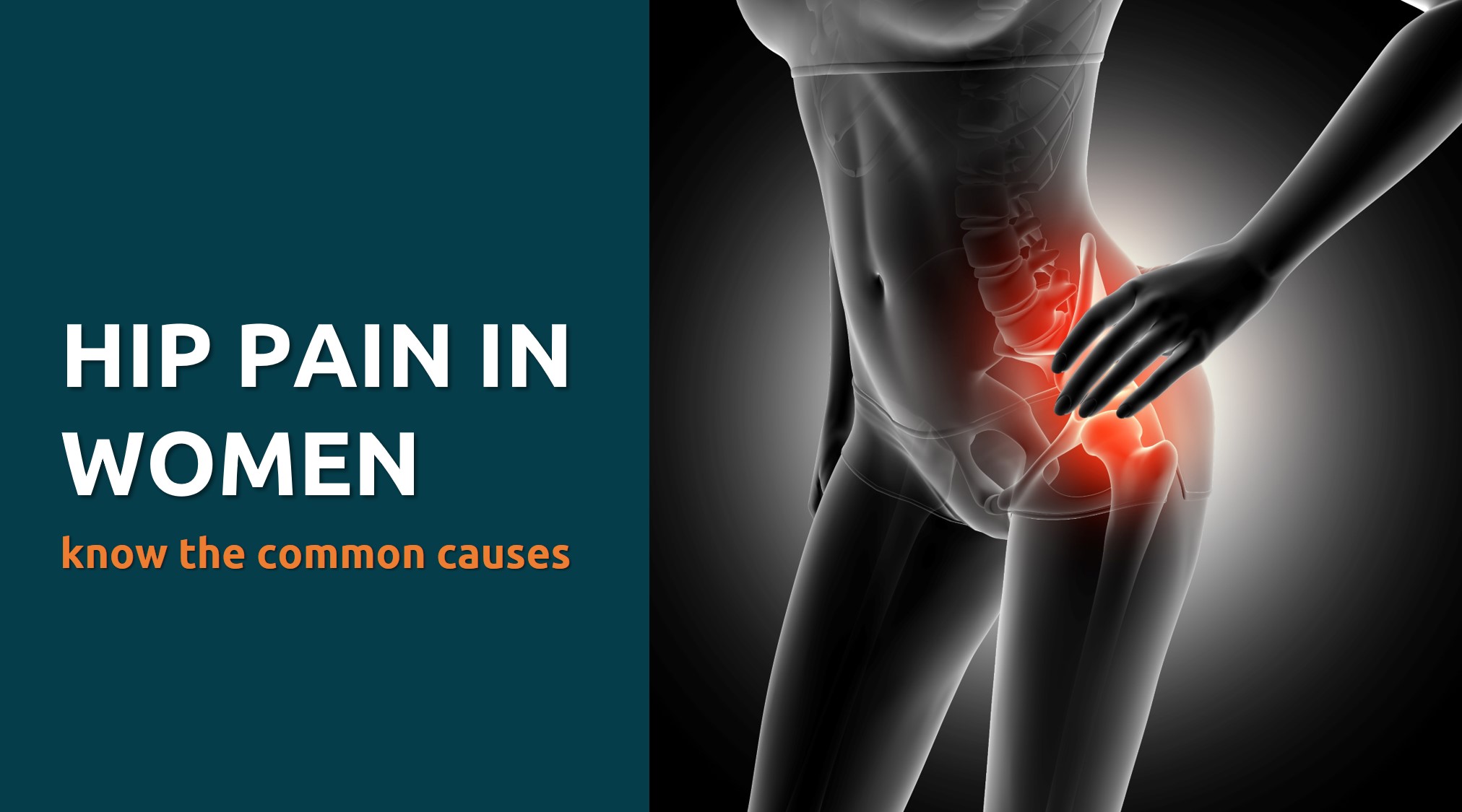 Common Causes Of Hip Pain In Women